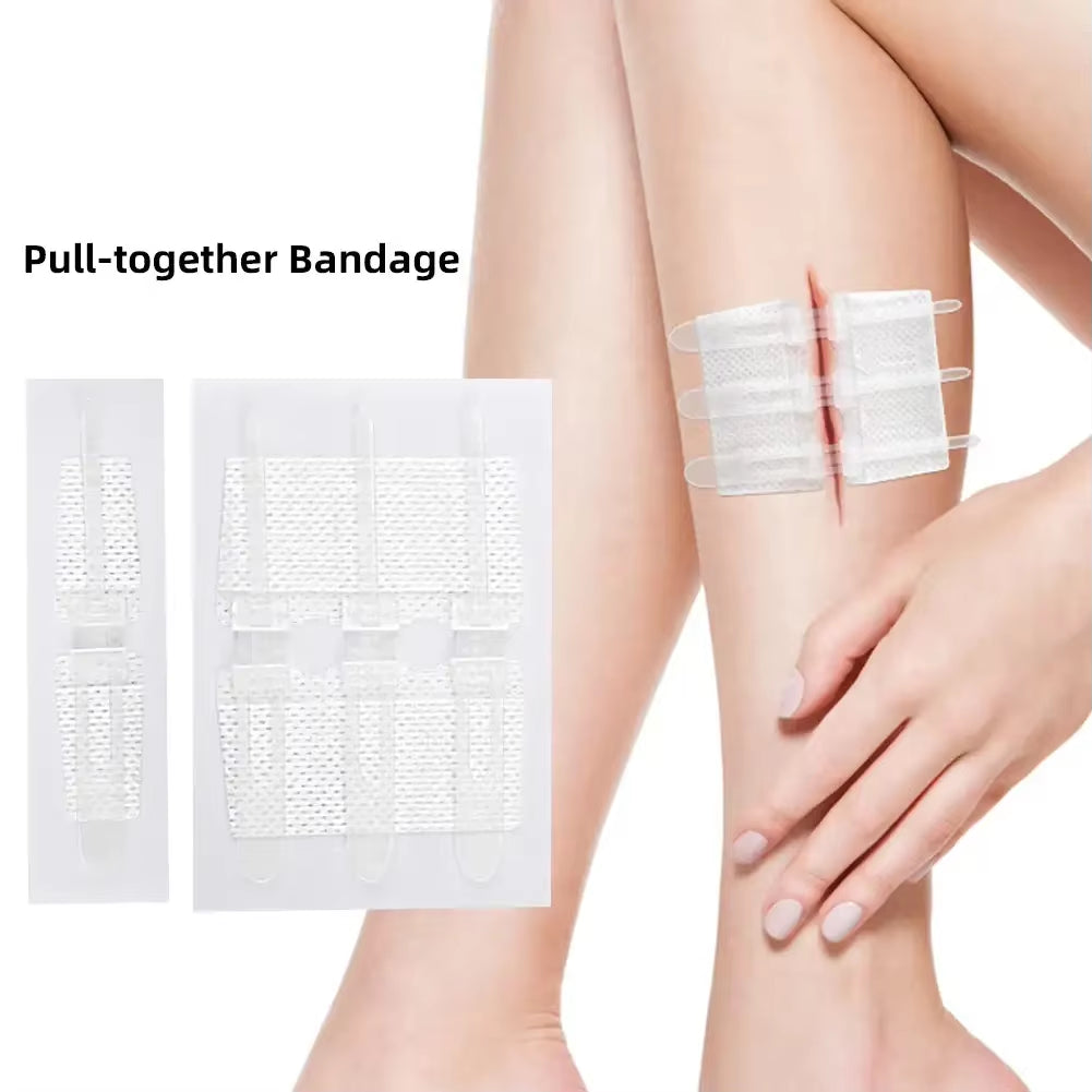 Suture Free Latches Pull-Together Self-Adhesive Bandage Independent Packaging Non-Woven Elastic Band Bandage Wound Care