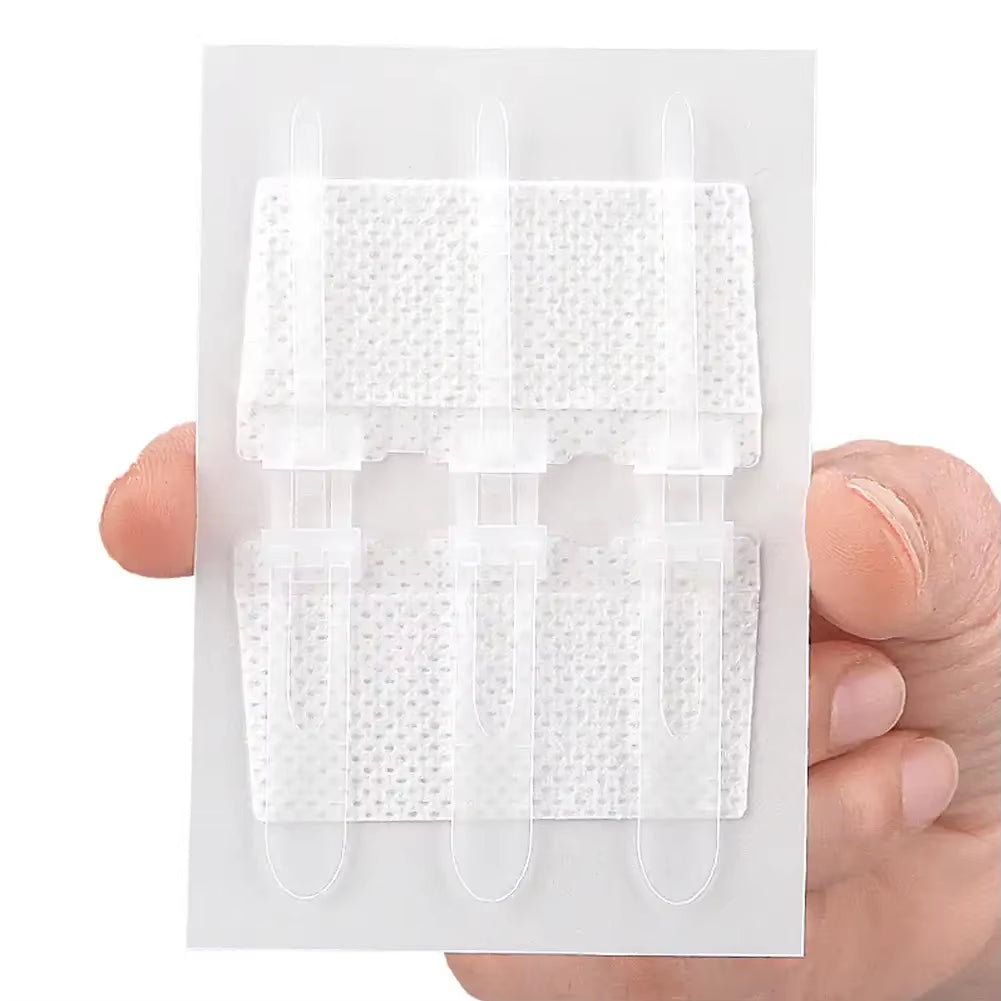 Suture Free Latches Pull-Together Self-Adhesive Bandage Independent Packaging Non-Woven Elastic Band Bandage Wound Care
