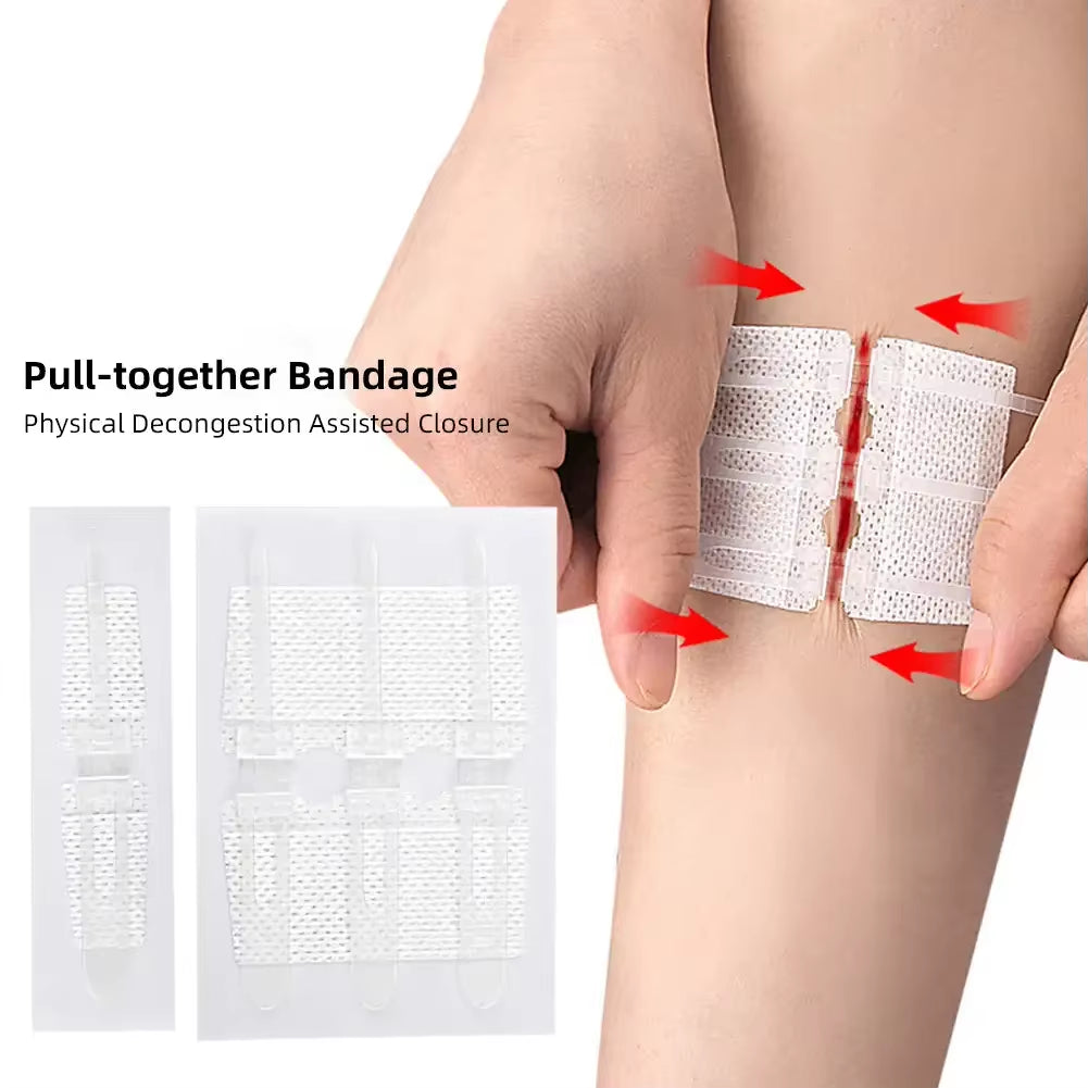 Suture Free Latches Pull-Together Self-Adhesive Bandage Independent Packaging Non-Woven Elastic Band Bandage Wound Care