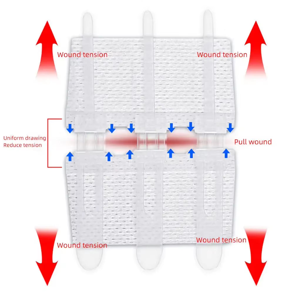 Suture Free Latches Pull-Together Self-Adhesive Bandage Independent Packaging Non-Woven Elastic Band Bandage Wound Care